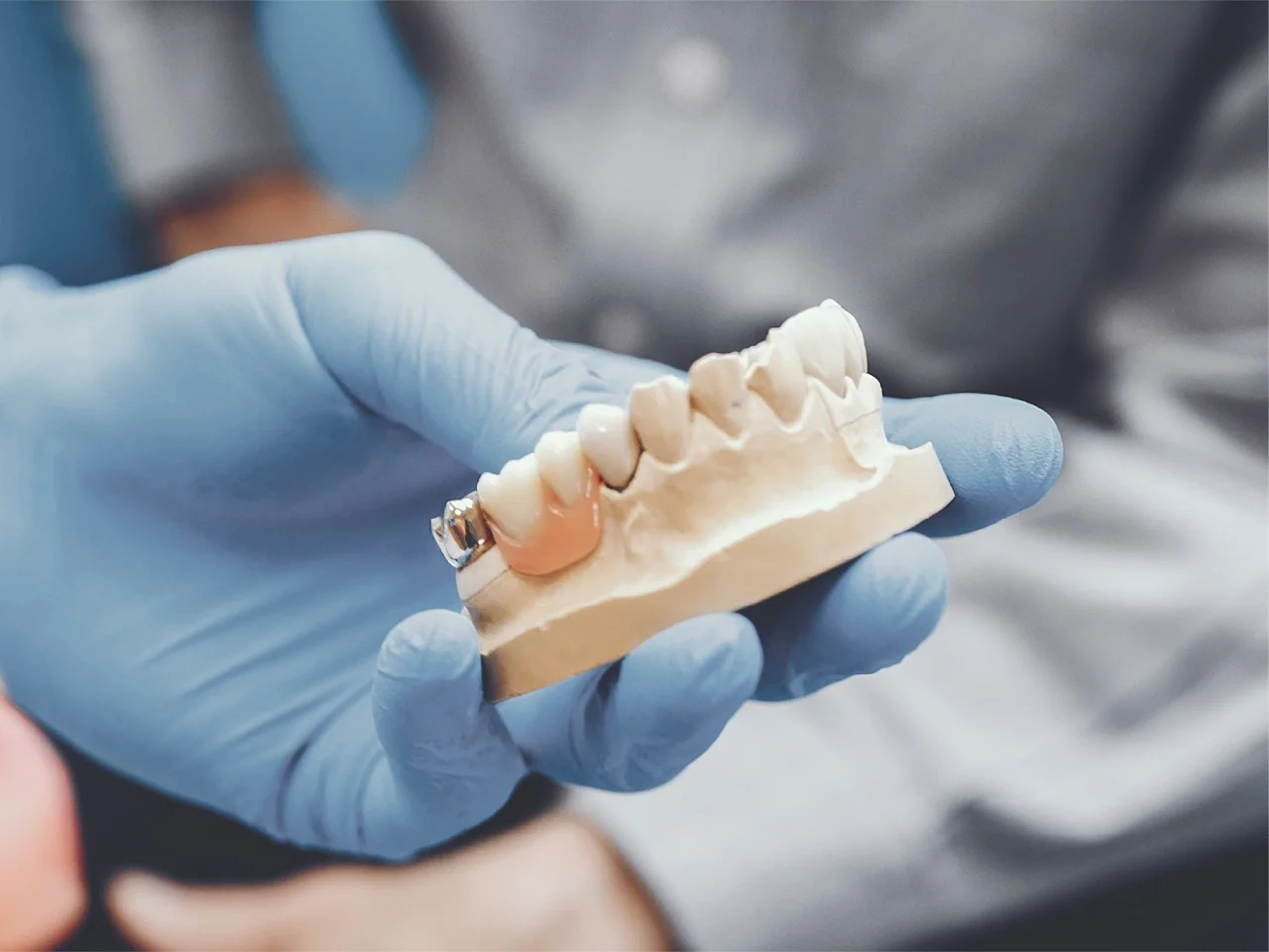 Rehabilitación Oral